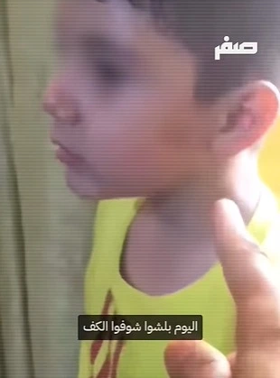صفعة معلمة تُورّم وجه طفل سوري داخل المدرسة